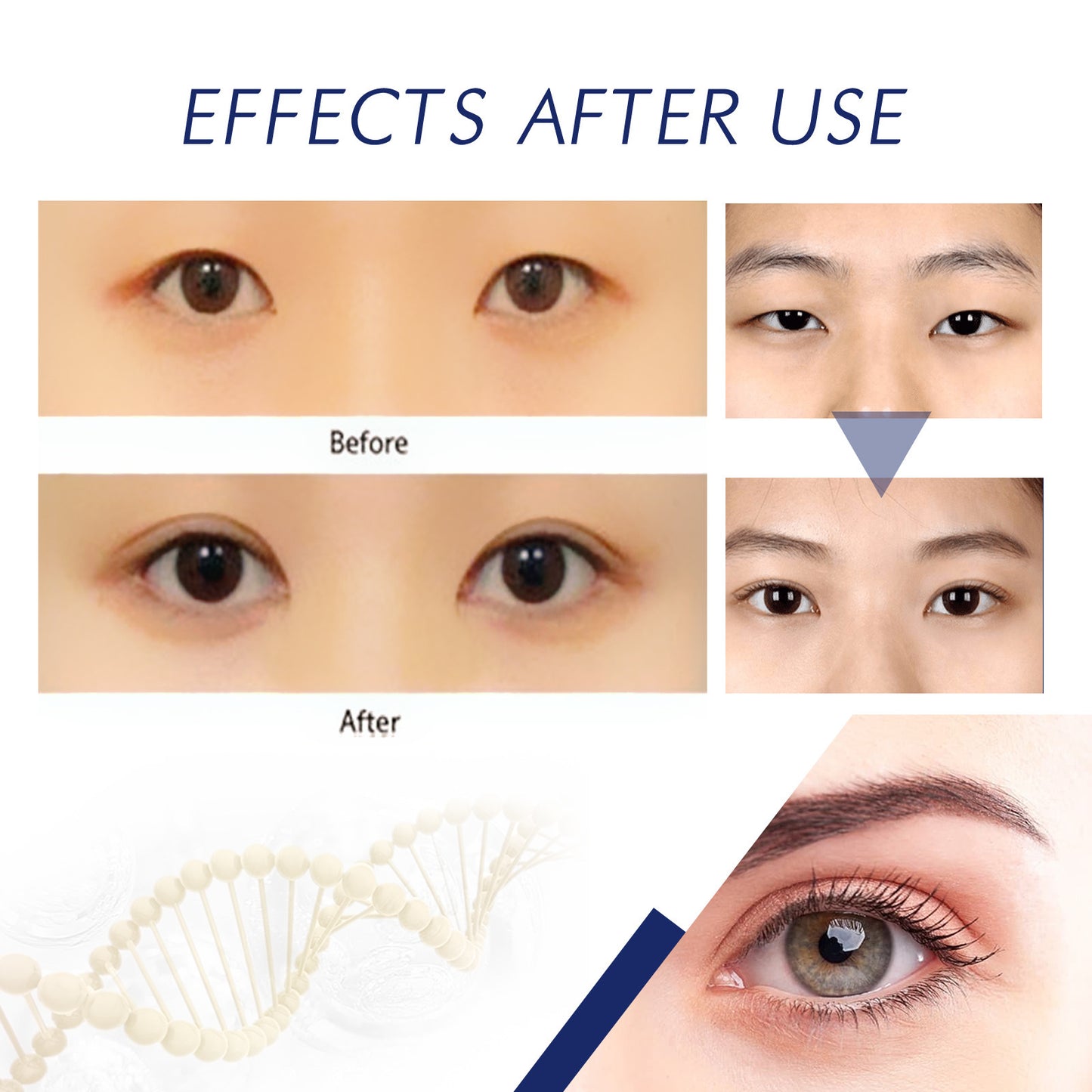 Eyelid Cream