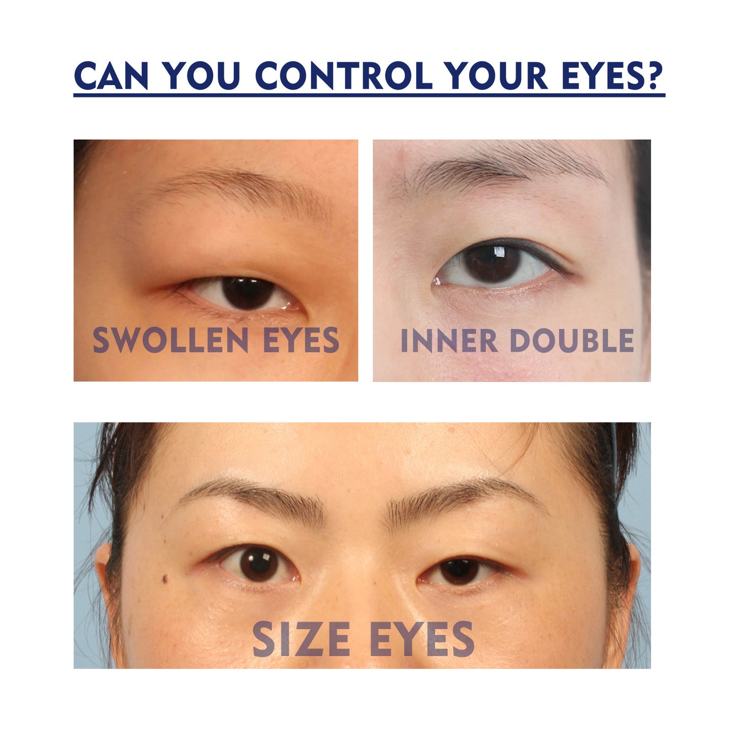 Eyelid Cream