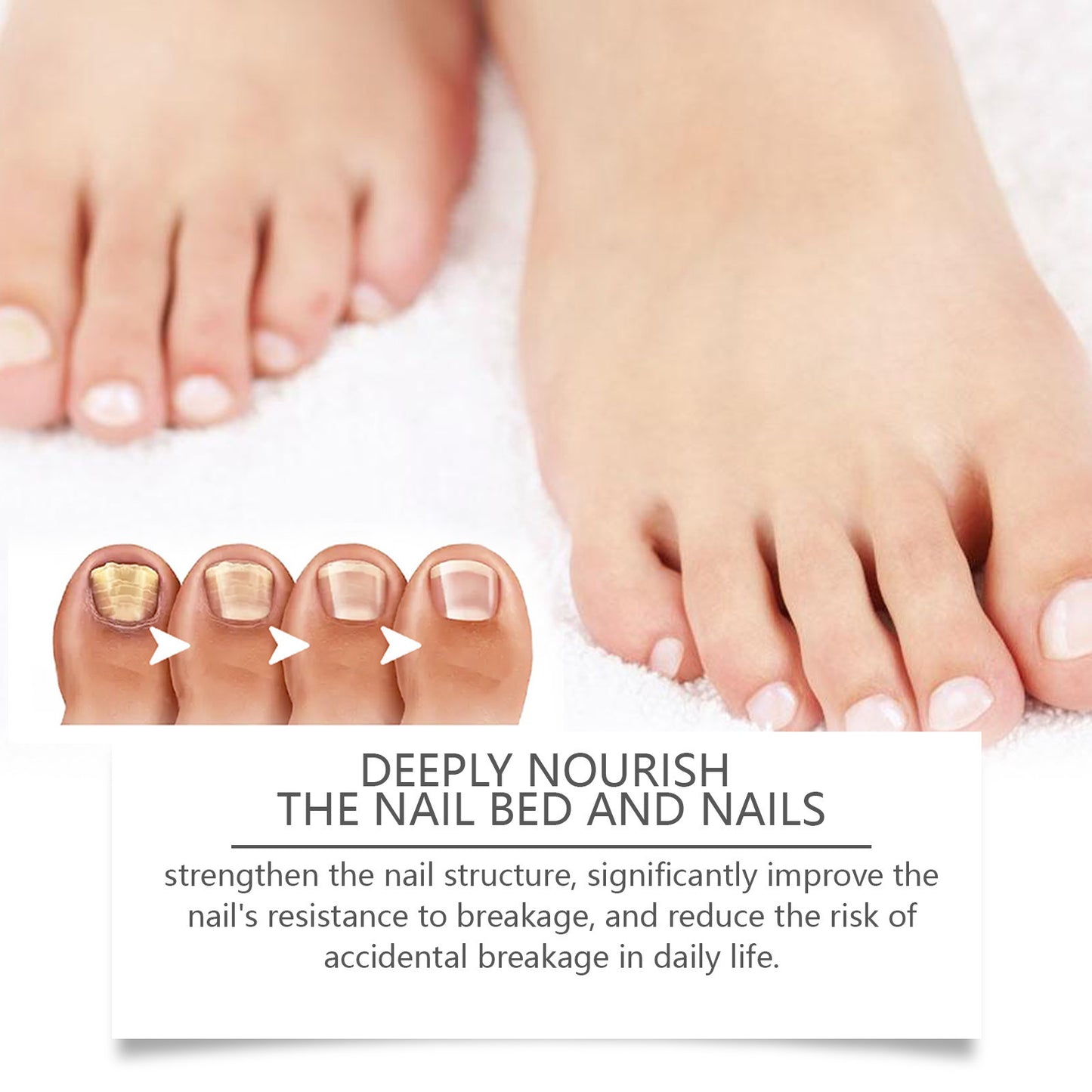 Nail Fungus Pen