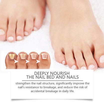 Nail Fungus Pen